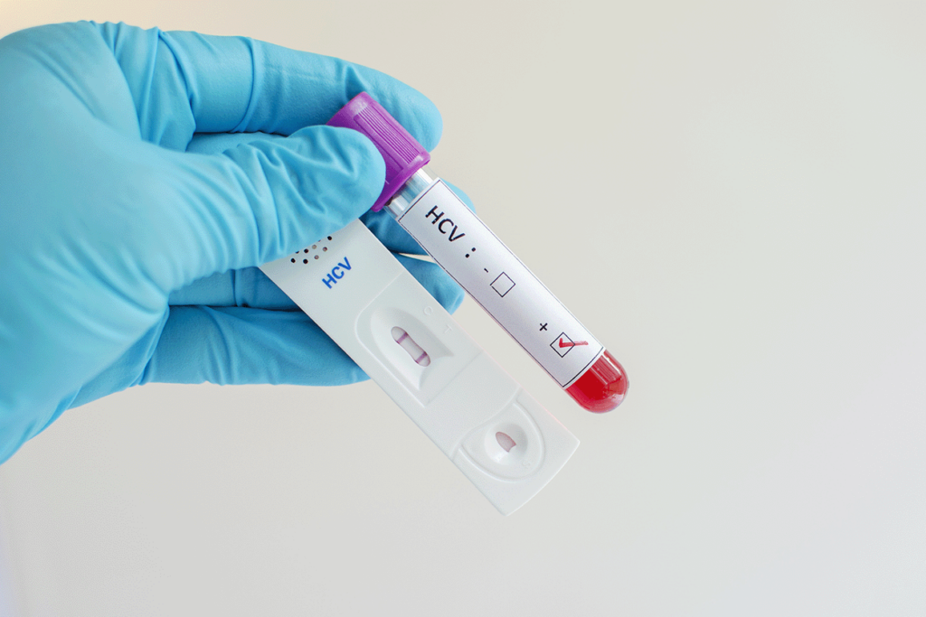 Hepatitis C at-home test